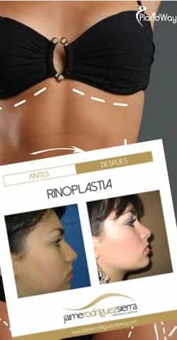 Cosmetic Surgery in Mexico Cosmetic Surgery in Mexico